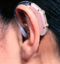 写真　補聴器